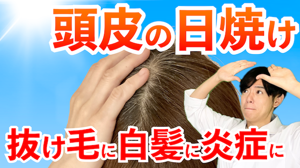 頭皮の日焼け対策