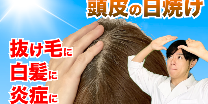 頭皮の日焼け対策